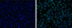 Anti-Japanese encephalitis virus Envelope antibody used in Immunocytochemistry/ Immunofluorescence (ICC/IF). GTX125867