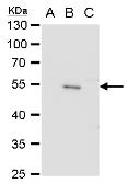 Anti-Japanese encephalitis virus Envelope antibody used in Western Blot (WB). GTX125867