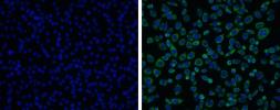 Anti-Japanese encephalitis virus NS3 antibody used in Immunocytochemistry/ Immunofluorescence (ICC/IF). GTX125868