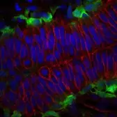 Anti-Cdh2 antibody used in IHC (Whole mount) (IHC-Wm). GTX125885