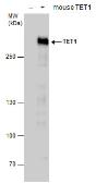 Anti-TET1 antibody [N1], N-term used in Western Blot (WB). GTX125888