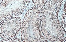 Anti-TET1 antibody [N1], N-term used in IHC (Paraffin sections) (IHC-P). GTX125888