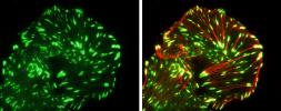 Anti-Paxillin antibody used in Immunocytochemistry/ Immunofluorescence (ICC/IF). GTX125891
