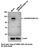 Anti-GEF-H1 antibody used in Western Blot (WB). GTX125893