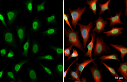 Anti-USP7 antibody used in Immunocytochemistry/ Immunofluorescence (ICC/IF). GTX125894