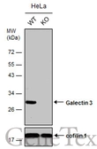 Anti-Galectin 3 antibody used in Western Blot (WB). GTX125897