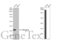 Anti-Galectin 4 antibody used in Western Blot (WB). GTX125898