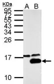 Anti-Galectin 7 antibody used in Western Blot (WB). GTX125900