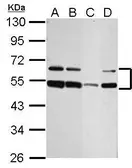 Anti-ST8SIA4 antibody used in Western Blot (WB). GTX125904
