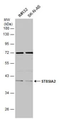 Anti-ST8SIA2 antibody used in Western Blot (WB). GTX125905