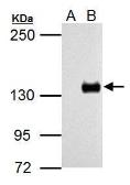 Anti-TLR7 antibody used in Western Blot (WB). GTX125910