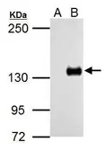 Anti-TLR7 antibody used in Western Blot (WB). GTX125910