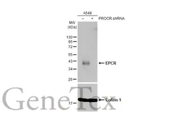 Anti-EPCR antibody used in Western Blot (WB). GTX125912