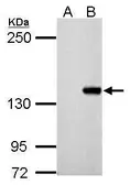 Anti-DNMT3B antibody used in Western Blot (WB). GTX125917