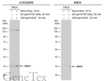 Anti-SNAI1 antibody used in Western Blot (WB). GTX125918