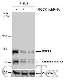 Anti-ROCK1 antibody used in Western Blot (WB). GTX125921