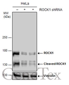 Anti-ROCK1 antibody used in Western Blot (WB). GTX125921