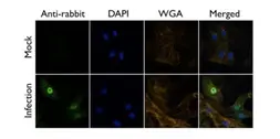 Anti-Influenza A virus PB1 protein antibody used in Immunocytochemistry/ Immunofluorescence (ICC/IF). GTX125923