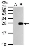 Anti-Influenza A virus M1 (matrix protein) antibody used in Western Blot (WB). GTX125928