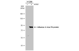 Three Kinds Of Antiinfluenza Agents Japanese Edition Free Download