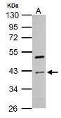 Anti-Cyclin I antibody used in Western Blot (WB). GTX125940