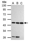 Anti-Cyclin I antibody used in Western Blot (WB). GTX125941