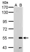 Anti-RAD26L antibody used in Western Blot (WB). GTX125943