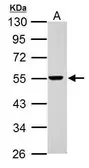 Anti-RAD26L antibody used in Western Blot (WB). GTX125944