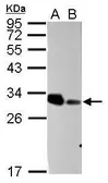 Anti-ARD1A antibody used in Western Blot (WB). GTX125971