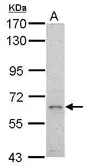 Anti-GRB10 antibody used in Western Blot (WB). GTX125980