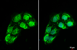 Anti-GPX8 antibody used in Immunocytochemistry/ Immunofluorescence (ICC/IF). GTX125992