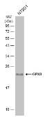 Anti-GPX8 antibody used in Western Blot (WB). GTX125992