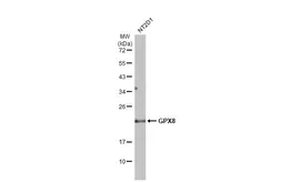 Anti-GPX8 antibody used in Western Blot (WB). GTX125992