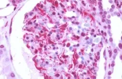 Anti-GPRC5B antibody used in IHC (Paraffin sections) (IHC-P). GTX12711