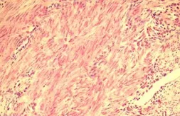 Anti-Relaxin Receptor 2 antibody used in IHC (Paraffin sections) (IHC-P). GTX12716