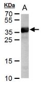 Anti-Cre recombinase antibody used in Western Blot (WB). GTX127271