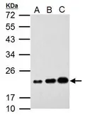 Anti-AICDA antibody used in Western Blot (WB). GTX127276