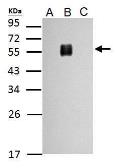Anti-Dengue virus Envelope protein antibody used in Western Blot (WB). GTX127277