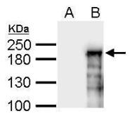 Anti-ASXL1 antibody used in Western Blot (WB). GTX127284