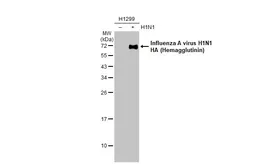 Anti-Influenza A virus H1N1 HA (Hemagglutinin) antibody used in Western Blot (WB). GTX127295
