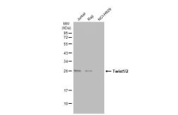 Anti-Twist1/2 antibody used in Western Blot (WB). GTX127310
