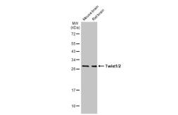 Anti-Twist1/2 antibody used in Western Blot (WB). GTX127310