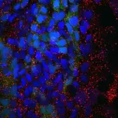Anti-Rab11a + Rab11b antibody used in Immunohistochemistry (IHC). GTX127328