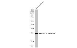 Anti-Rab11a + Rab11b antibody used in Western Blot (WB). GTX127328