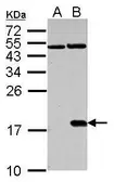 Anti-Histone H2A.XS139ph (phospho Ser139) antibody used in Western Blot (WB). GTX127340