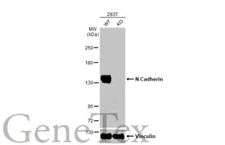 Anti-N-Cadherin antibody used in Western Blot (WB). GTX127345