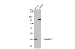 Anti-Galectin 9 antibody used in Western Blot (WB). GTX127353