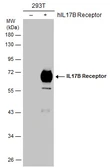 Anti-IL17 Receptor beta antibody used in Western Blot (WB). GTX127368
