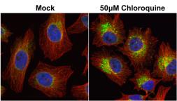 Anti-LC3B antibody used in Immunocytochemistry/ Immunofluorescence (ICC/IF). GTX127375