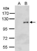 Anti-HA tag antibody (HRP) used in Western Blot (WB). GTX127376-01